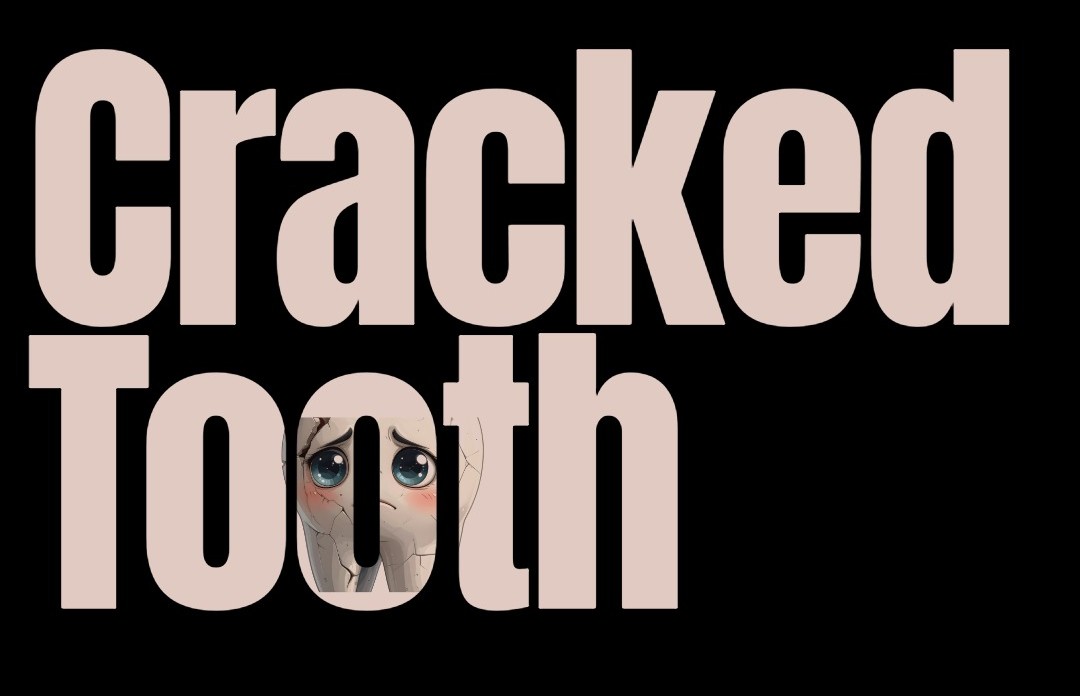 Tooth fractures and cracks Tooth fractures and cracks