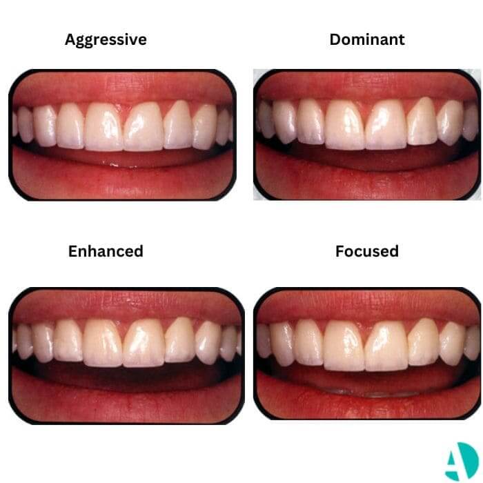 Types of veneers first collection
