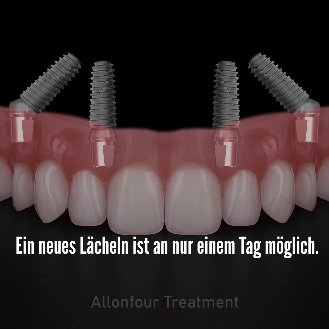 ein neues Lächeln in nur einem Tag