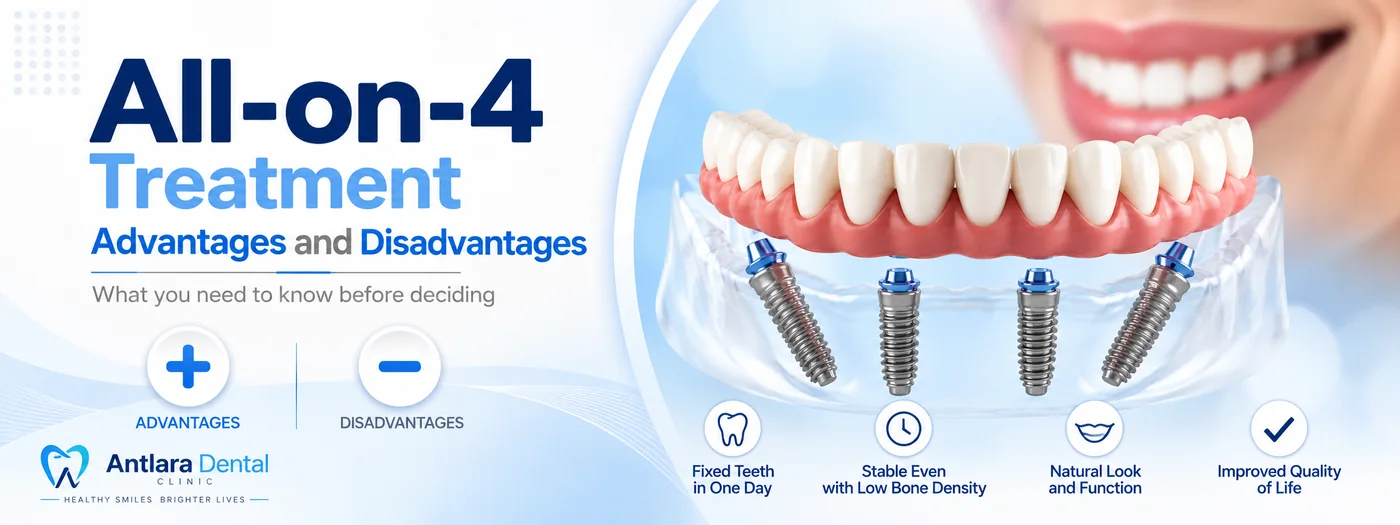 All-on-4 treatment advantages and disadvantages, what to know before deciding
