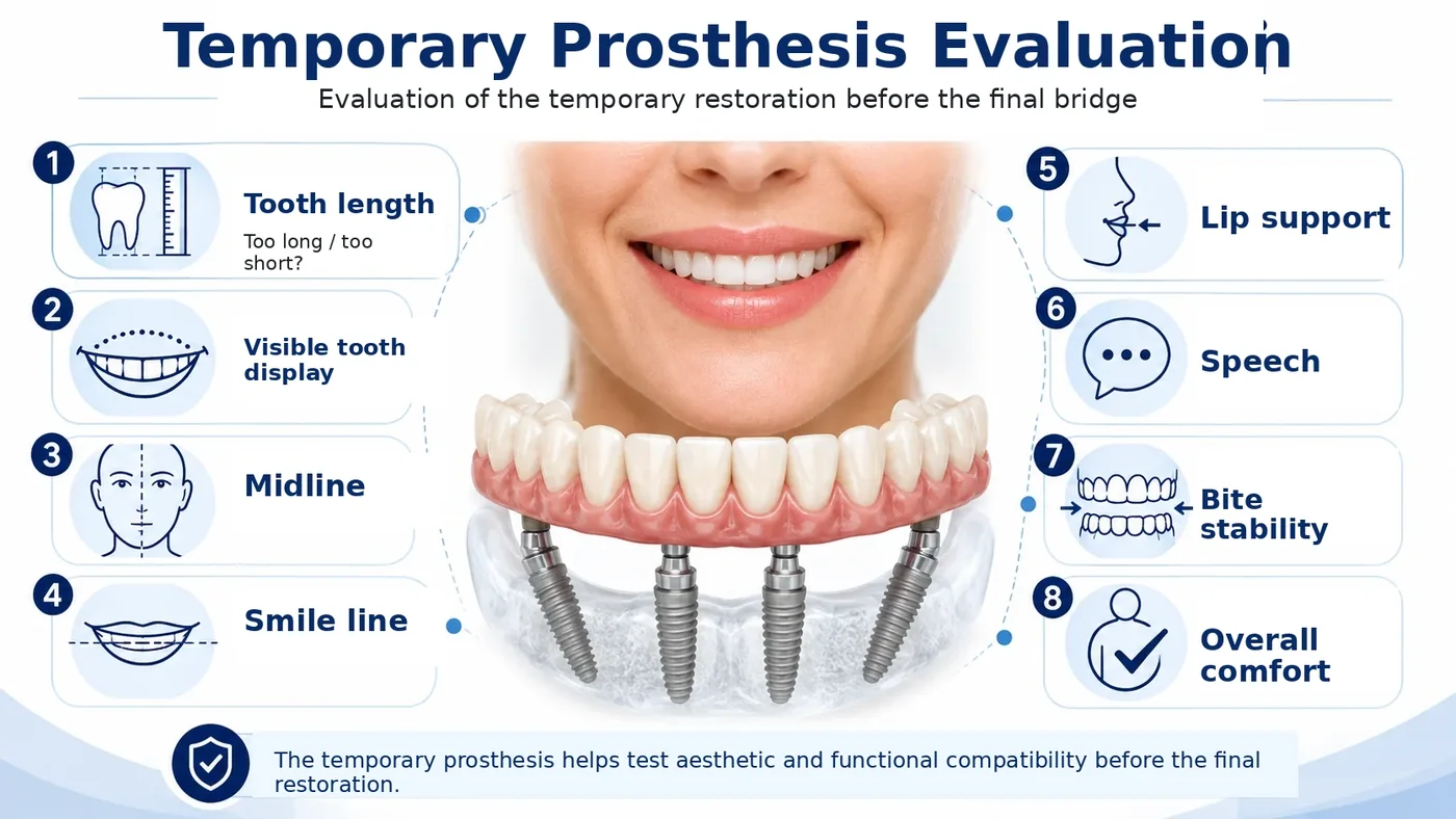 Eight checks used to evaluate the temporary All-on-4 prosthesis before the final bridge