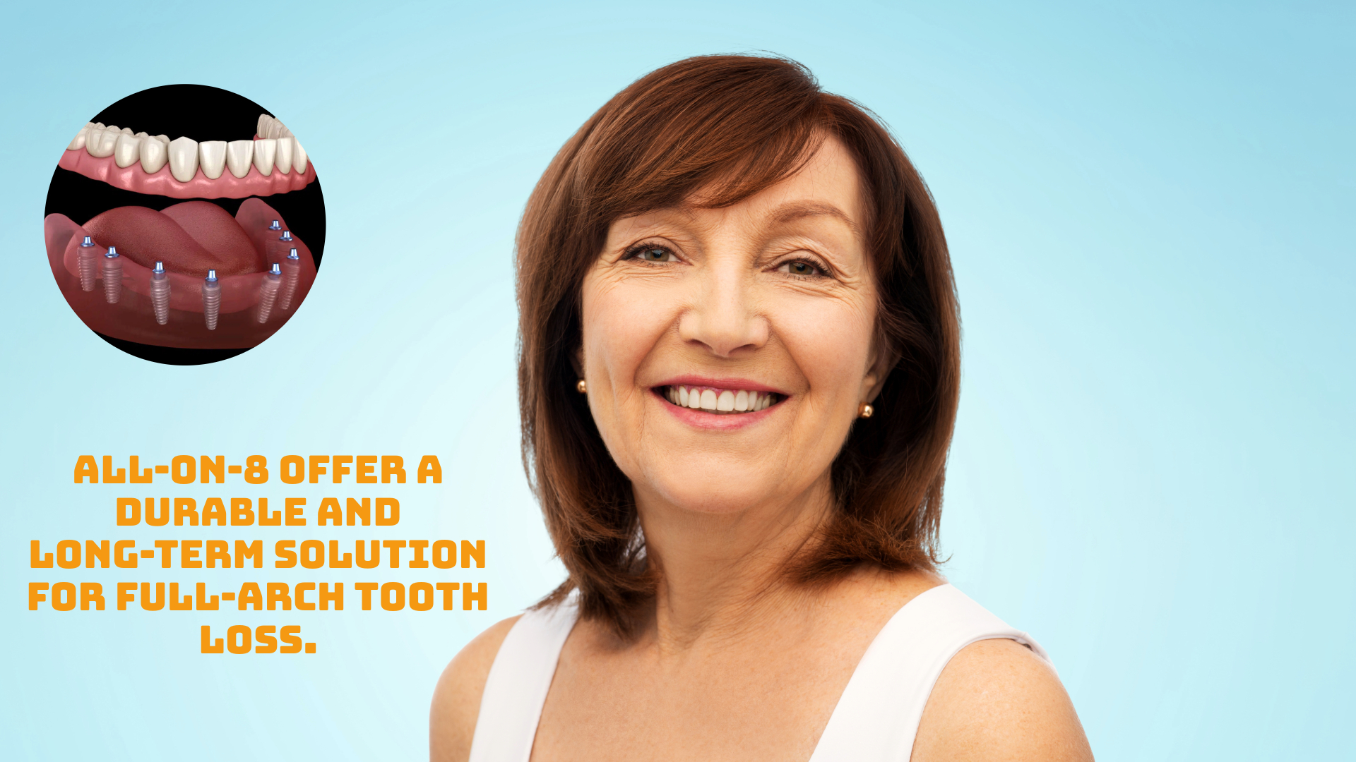 All-on-8 Dental Implants in Turkey All-on-8 Dental Implants in Turkey