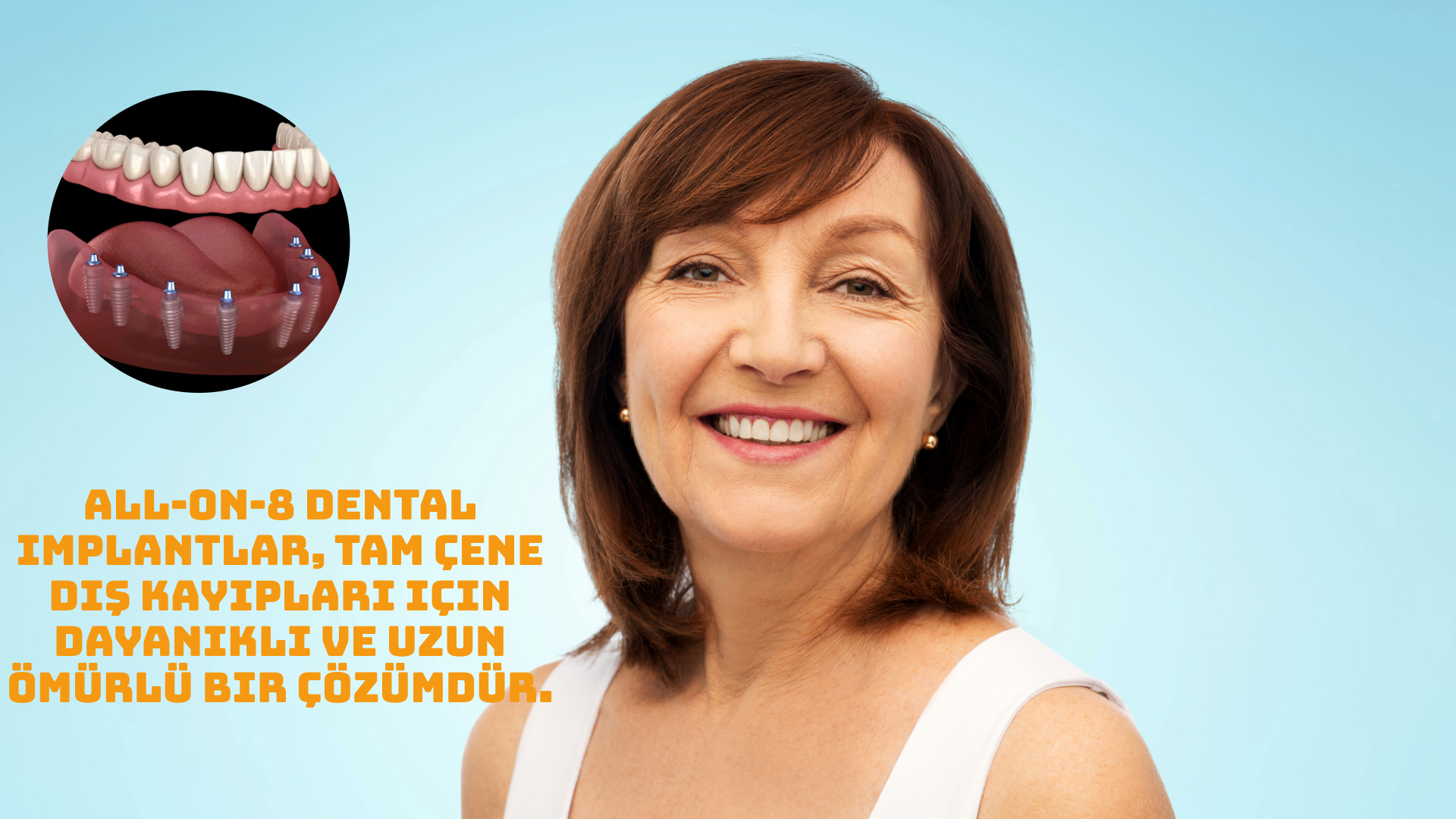 All-On-8 İmplant Nedir, Nasıl Yapılır, Kimlere Yapılır? All-On-8, All-On-4 ve All-On-6 Farkları Antalya