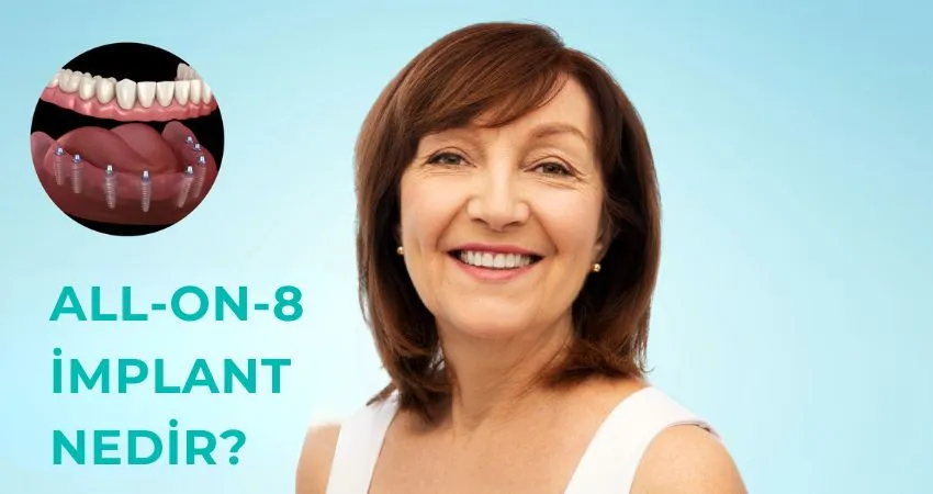 All-On-8 İmplant Nedir, Nasıl Yapılır, Kimlere Yapılır? All-On-8, All-On-4 ve All-On-6 Farkları Antalya