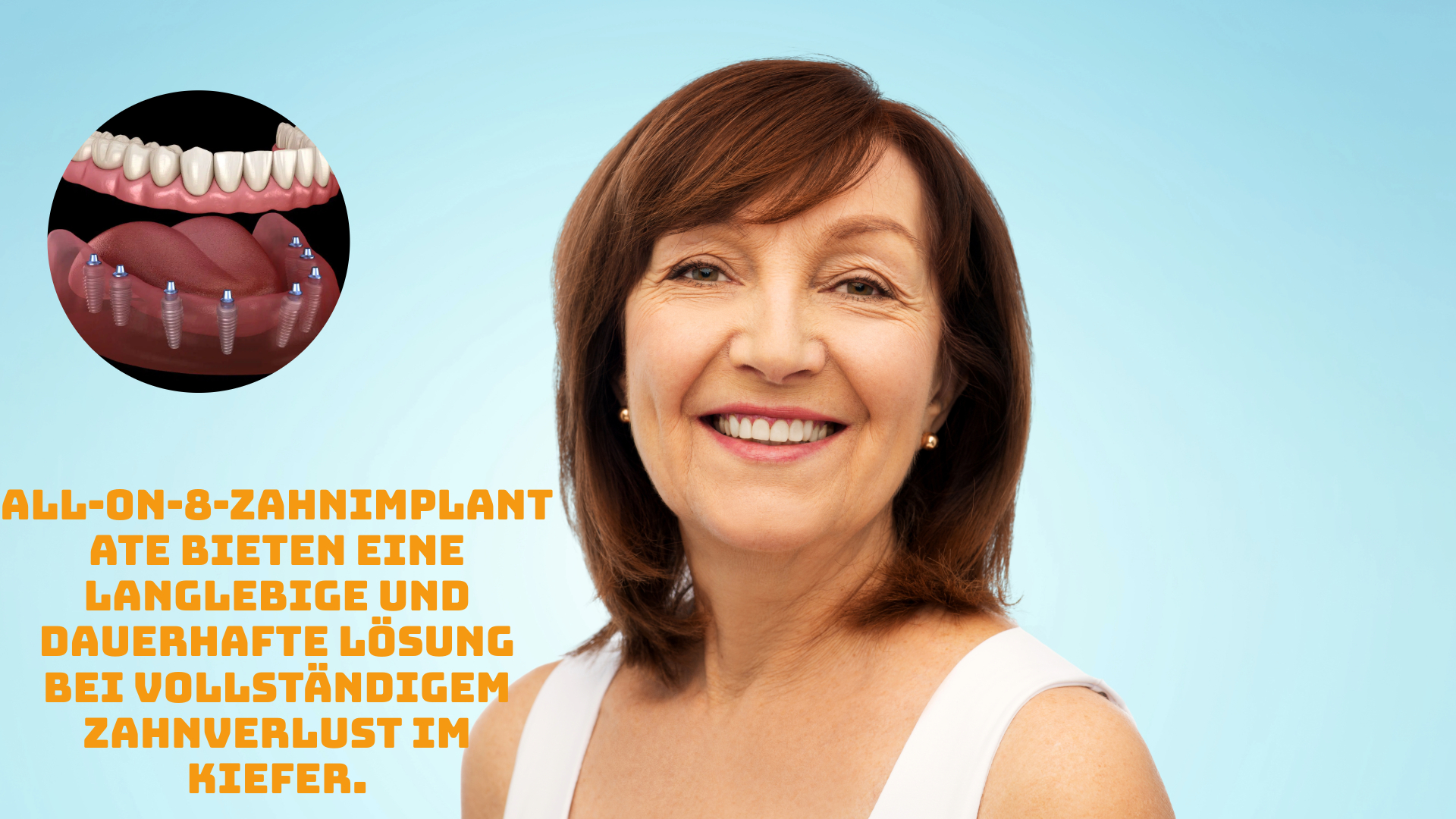 all-on-8-zahnimplantate-1 all-on-8-zahnimplantate-1