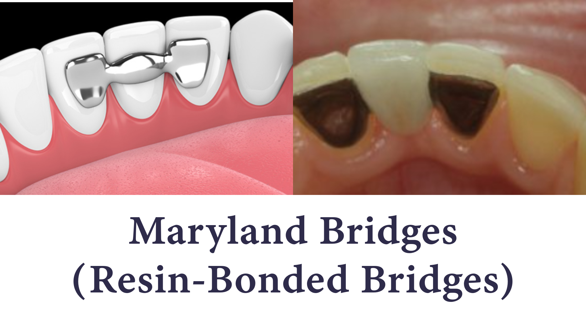 Maryland Bridges Maryland Bridges