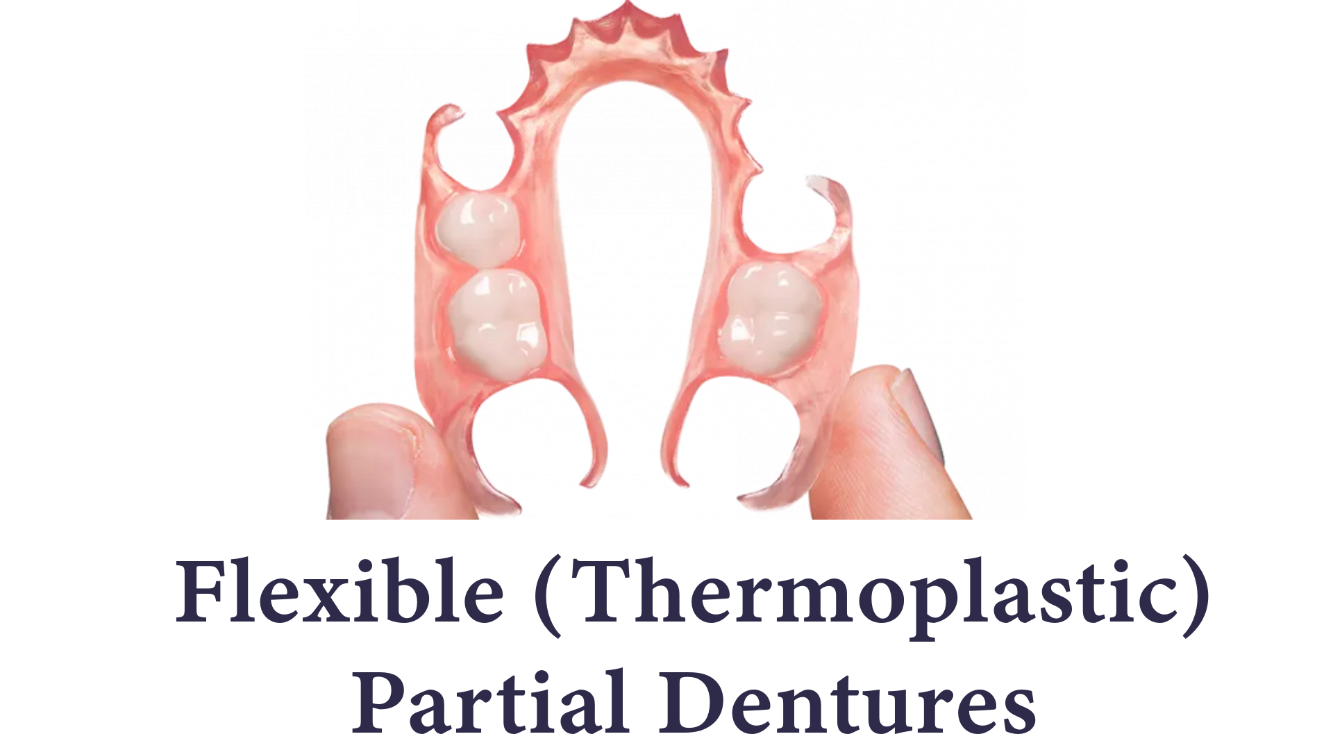 Flexible (Thermoplastic) Partial Dentures Flexible (Thermoplastic) Partial Dentures