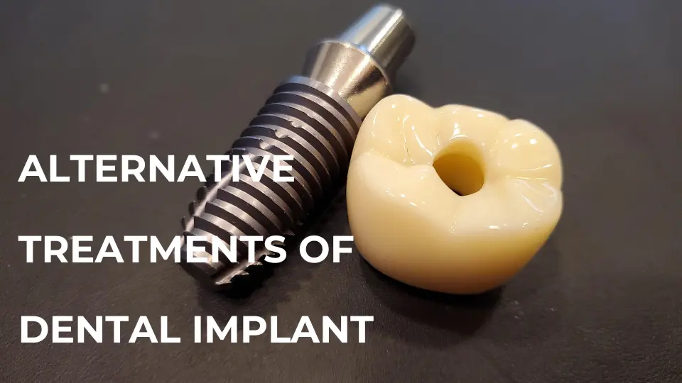 Alternatives to Dental Implants