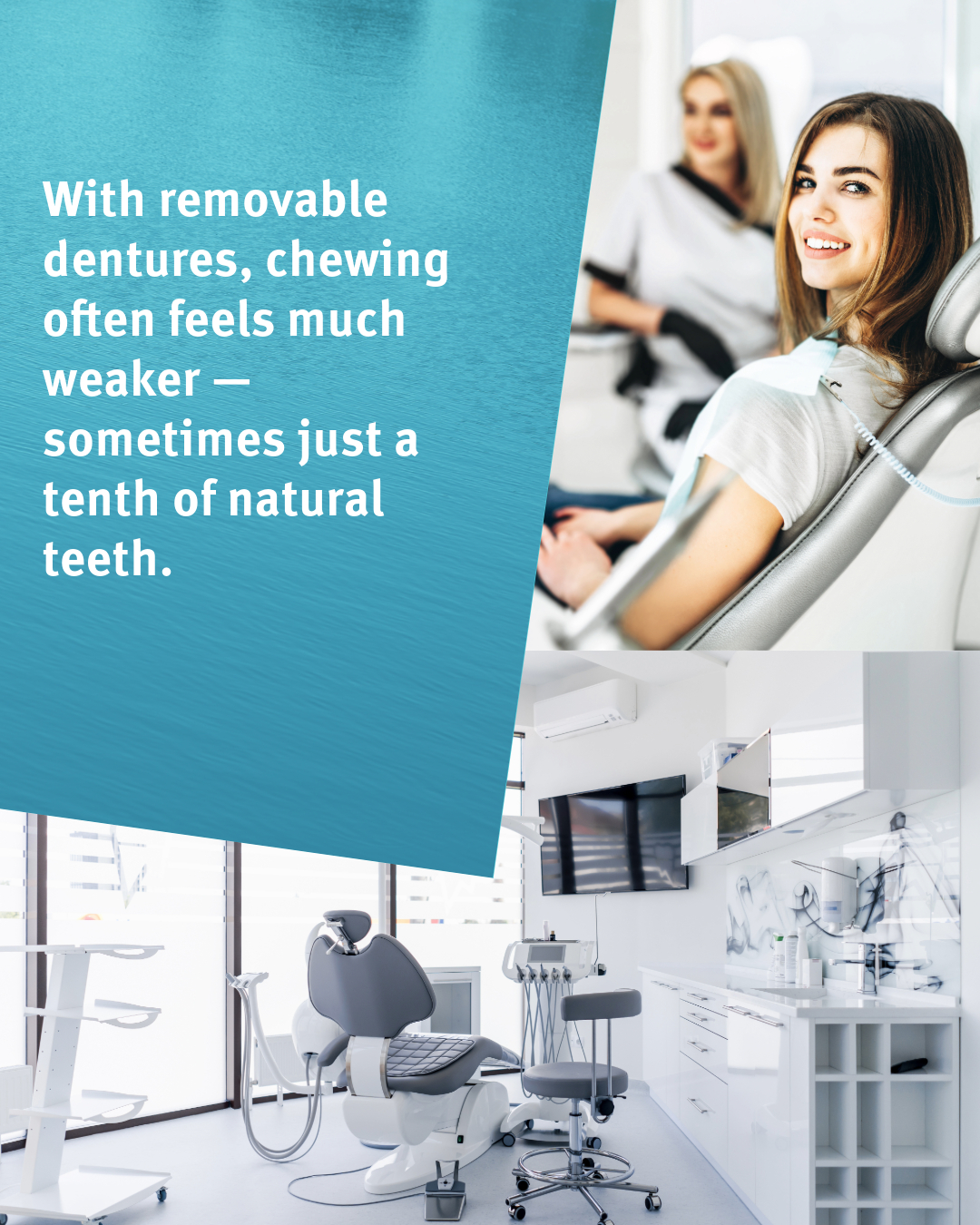 Alternative to dentures with gum disease Alternative to dentures with gum disease