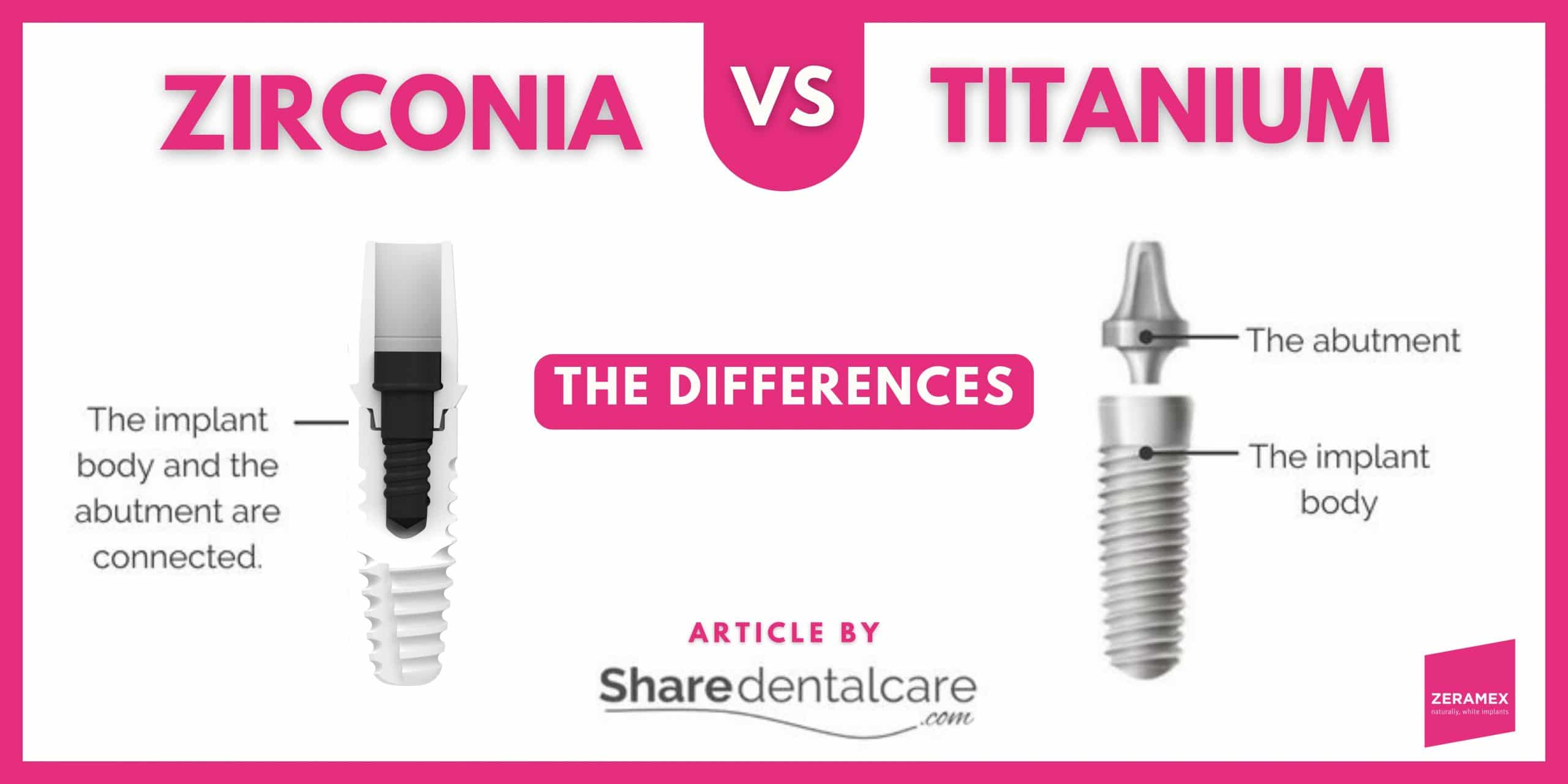 Which implant is better: Titanium or ceramic? Which implant is better: Titanium or ceramic?