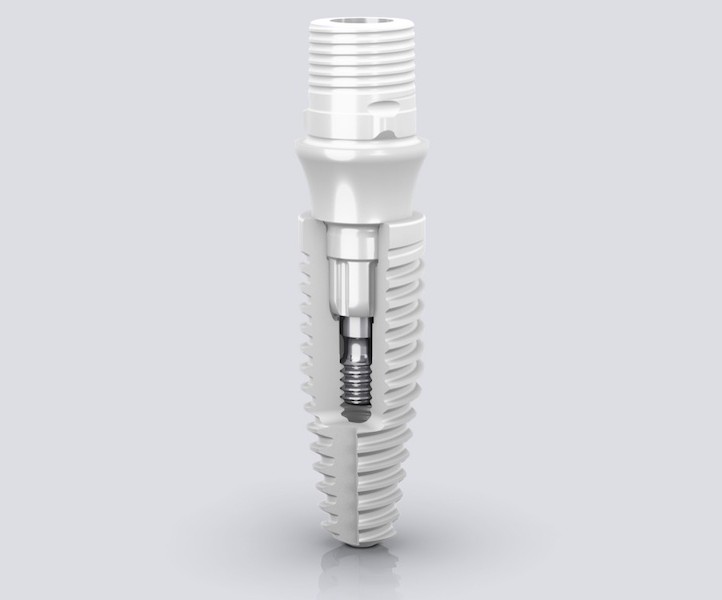 Ceramic Dental Implants in Turkey