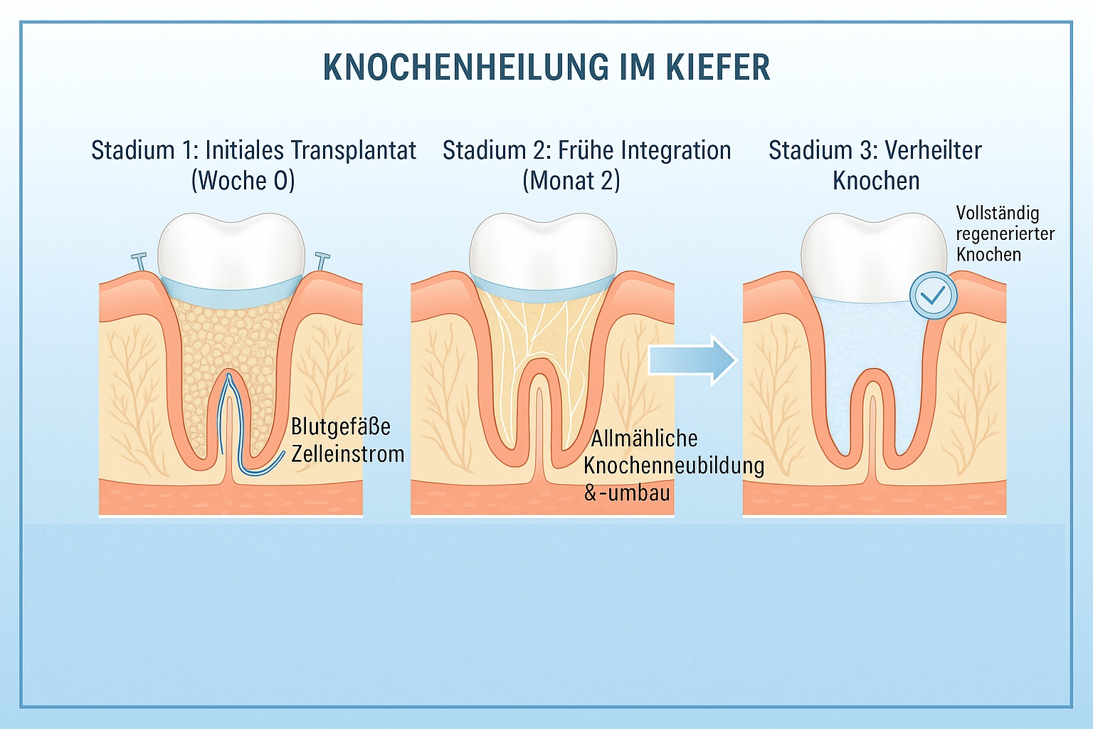 Wiederherstellungsprozess und Ergebnisse 
