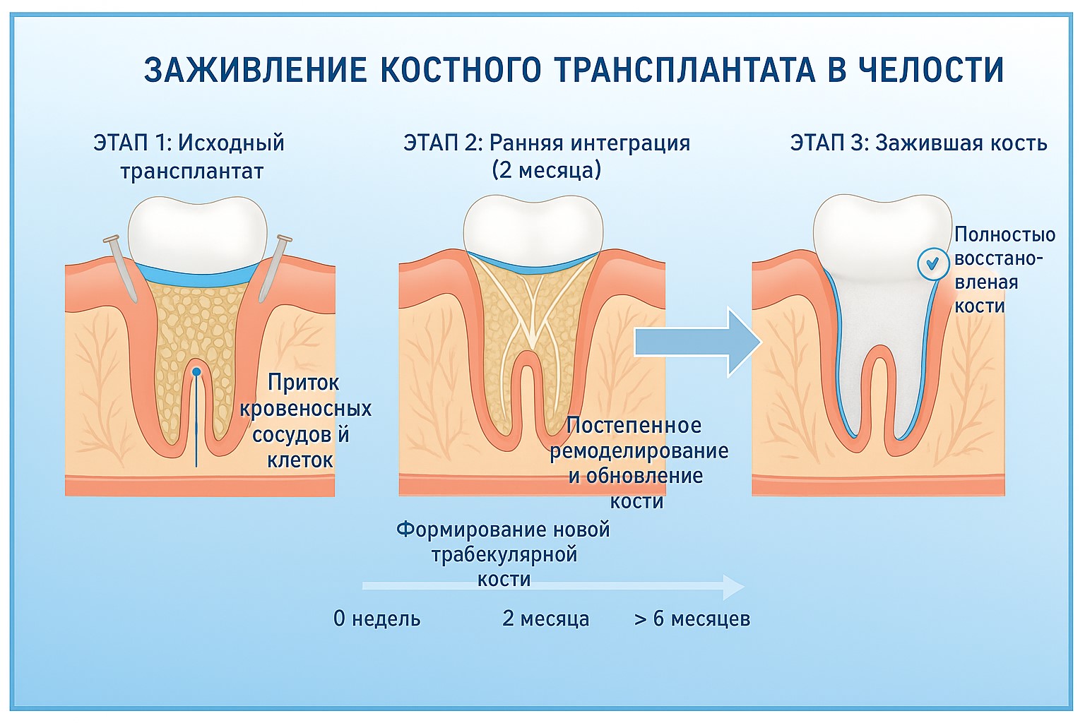  Процесс восстановления и результаты  