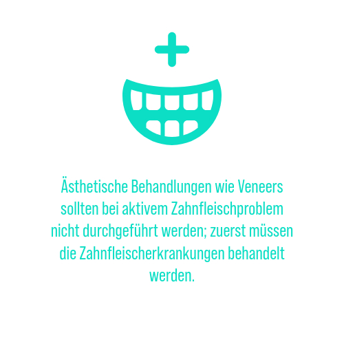 Kann man mit Parodontitis Veneers machen?