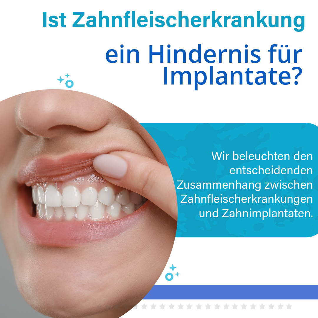 Sind Implantate bei Parodontose möglich?