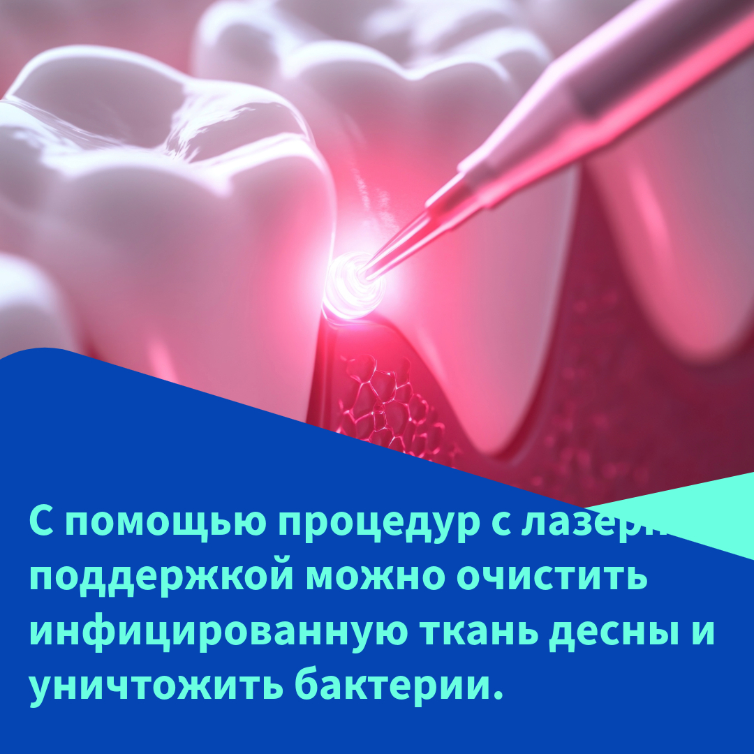   Как восстановить десны, если они опустились? 