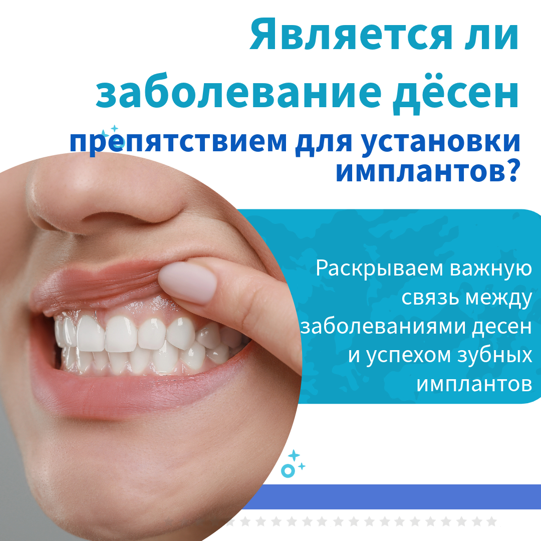  Можно ли мне установить зубной имплантат, если у меня заболевание десен? 