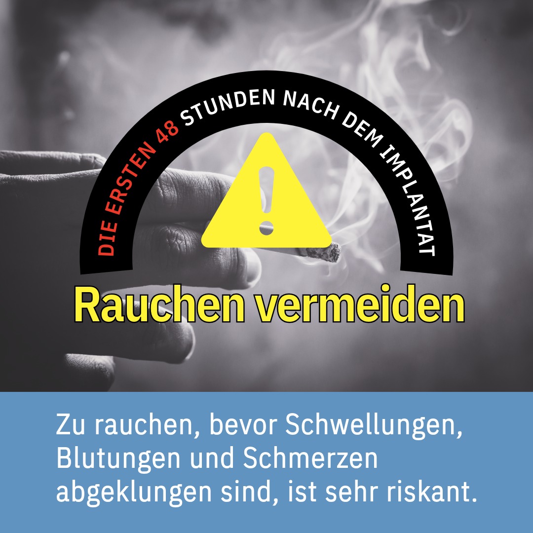 Die ersten 48 Stunden nach dem Implantat: Warum sollten Sie nicht rauchen?