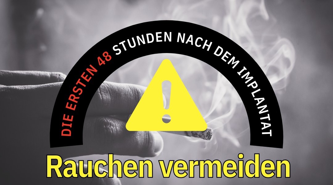Die ersten 48 Stunden nach dem Implantat: Warum sollten Sie nicht rauchen?