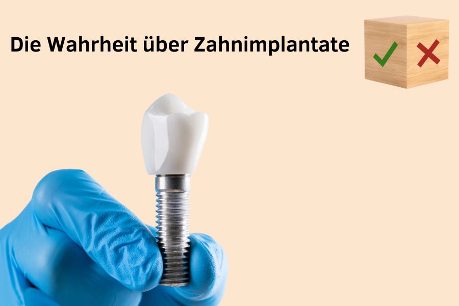 8 Dinge, die man über Zahnimplantate falsch versteht