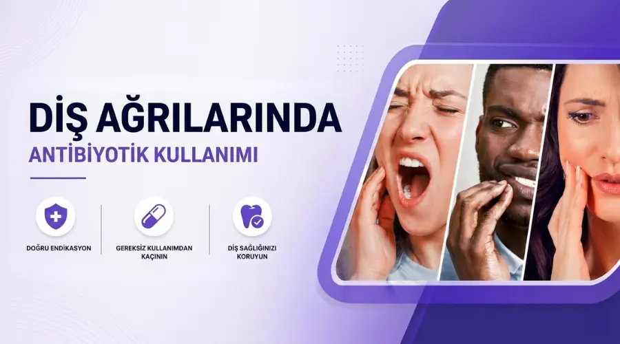 Diş Ağrılarında Antibiyotik Kullanımı