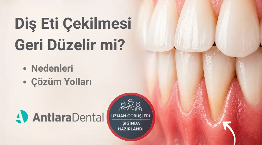 Diş Eti Çekilmesi Geri Düzelir mi? Nedenleri ve Çözüm Yolları | Antlara Dental Antalya