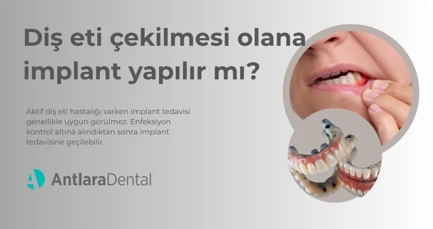 Diş Eti Çekilmesi Olana İmplant Yapılır mı?  Antalya