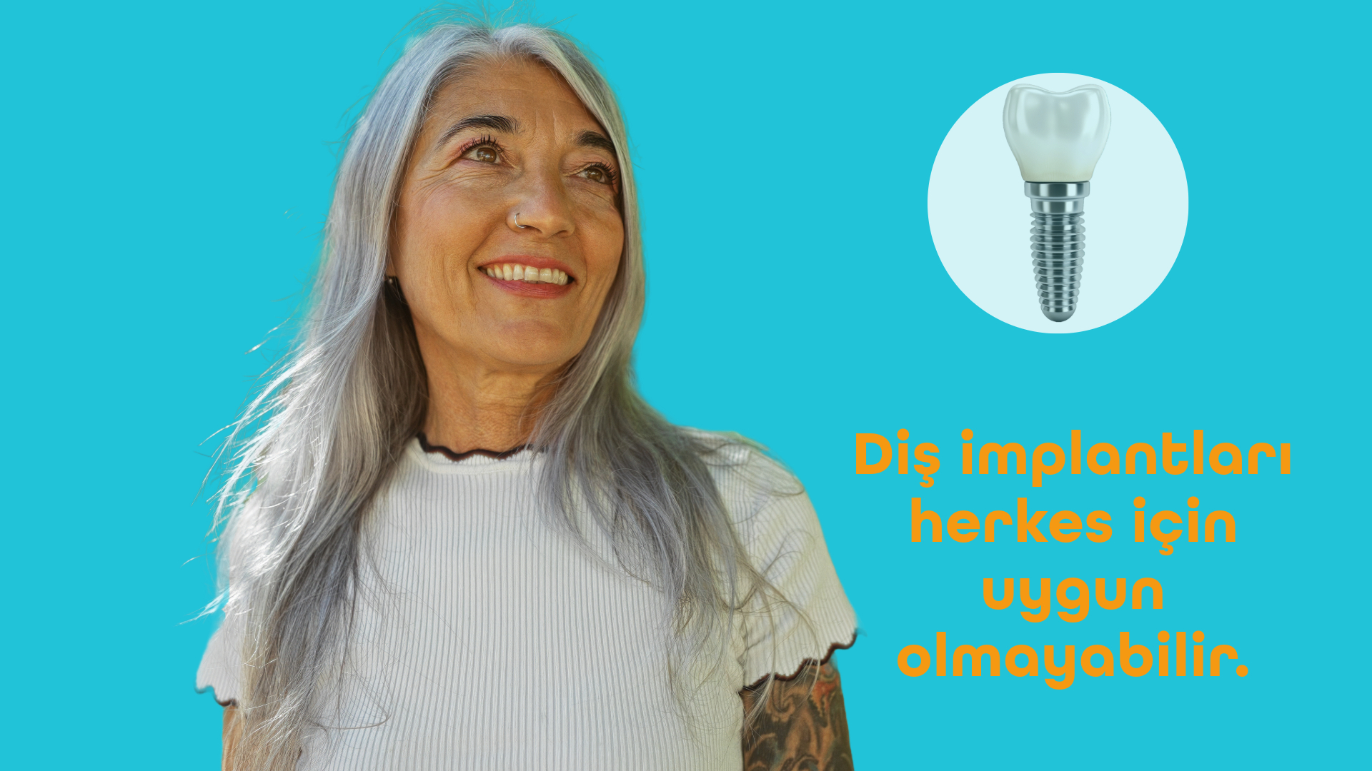 İmplant Diş Öncesi Bu Uyarılara Dikkat! 10 Kritik Engel Antalya