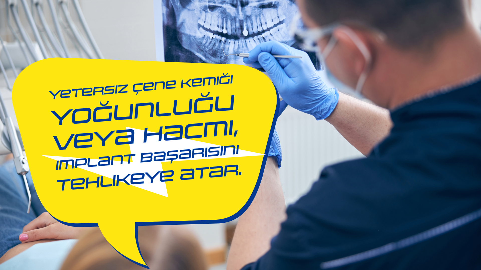 Diş İmplantı Kimlere Uygulanmaz? 10 Kritik Engel - Antalya İmplant Diş Öncesi Bu Uyarılara Dikkat! 10 Kritik Engel Antalya