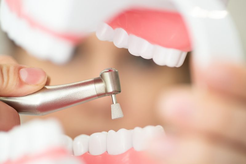 Diş Taşı Temizliği Nasıl Yapılır? Antalya