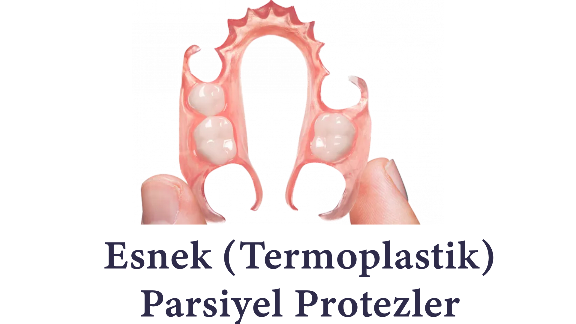 İmplantın Alternatifi Esnek (Termoplastik) Parsiyel Protezler (Flexible Dentures) İmplantın Alternatifi Esnek (Termoplastik) Parsiyel Protezler (Flexible Dentures) Antalya