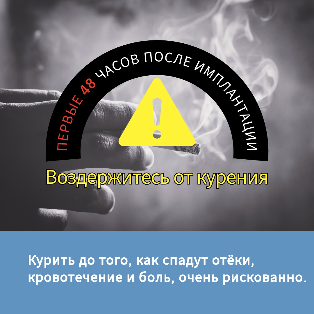  Первые 48 часов после имплантации: почему не стоит курить?
