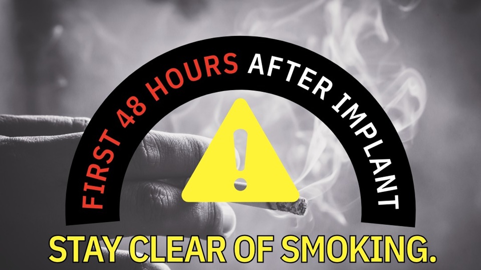 First 48 Hours After an Implant: Why You Shouldn't Smoke