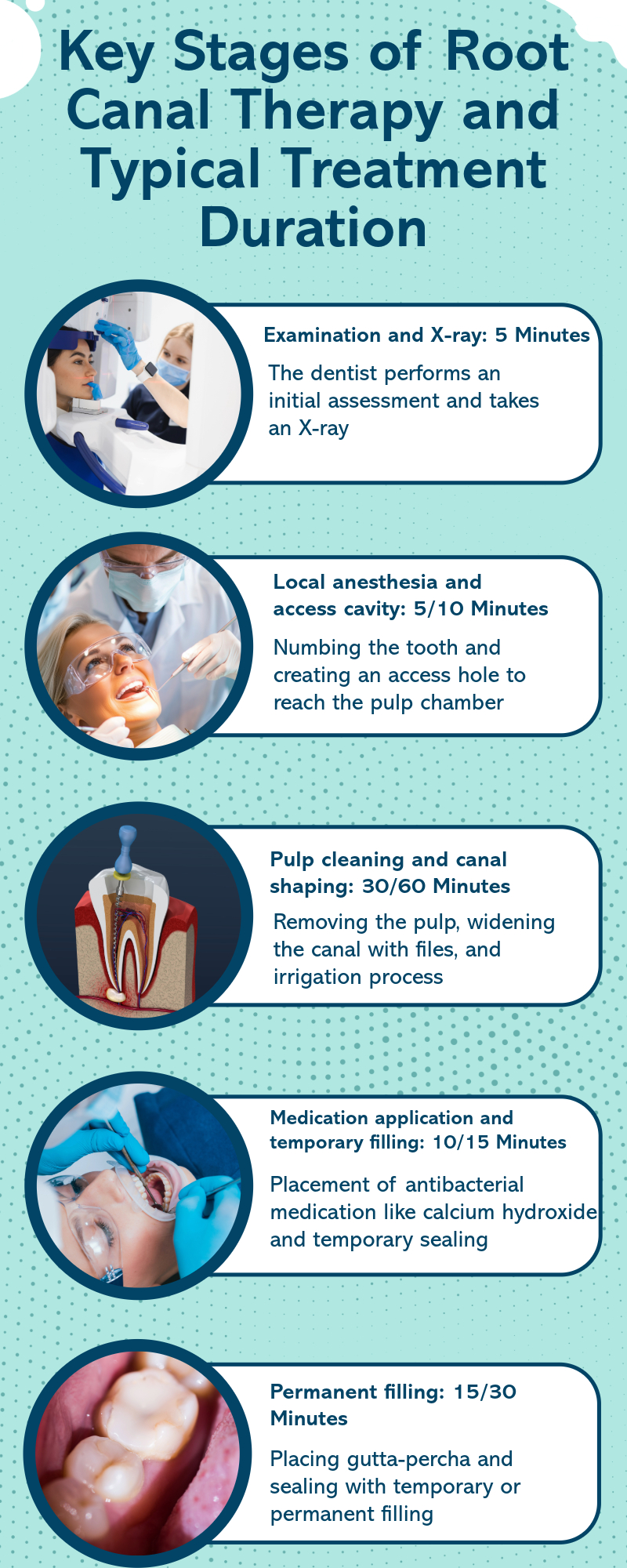How Long Does a Root Canal Take?