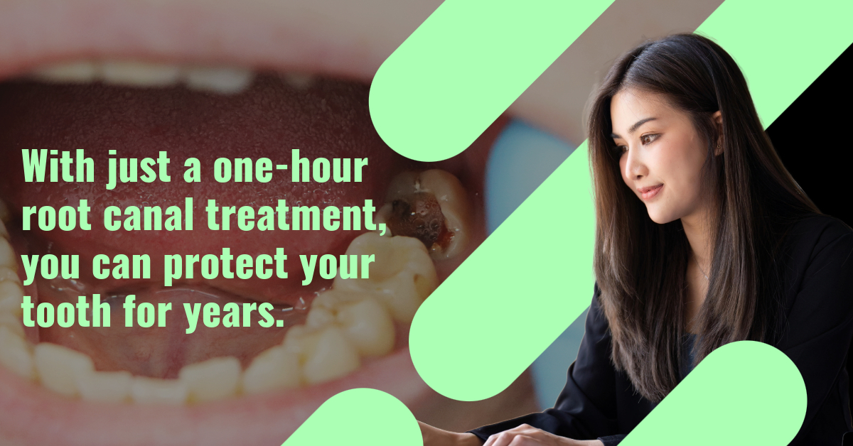 How Long Does Root Canal Treatment Take?
