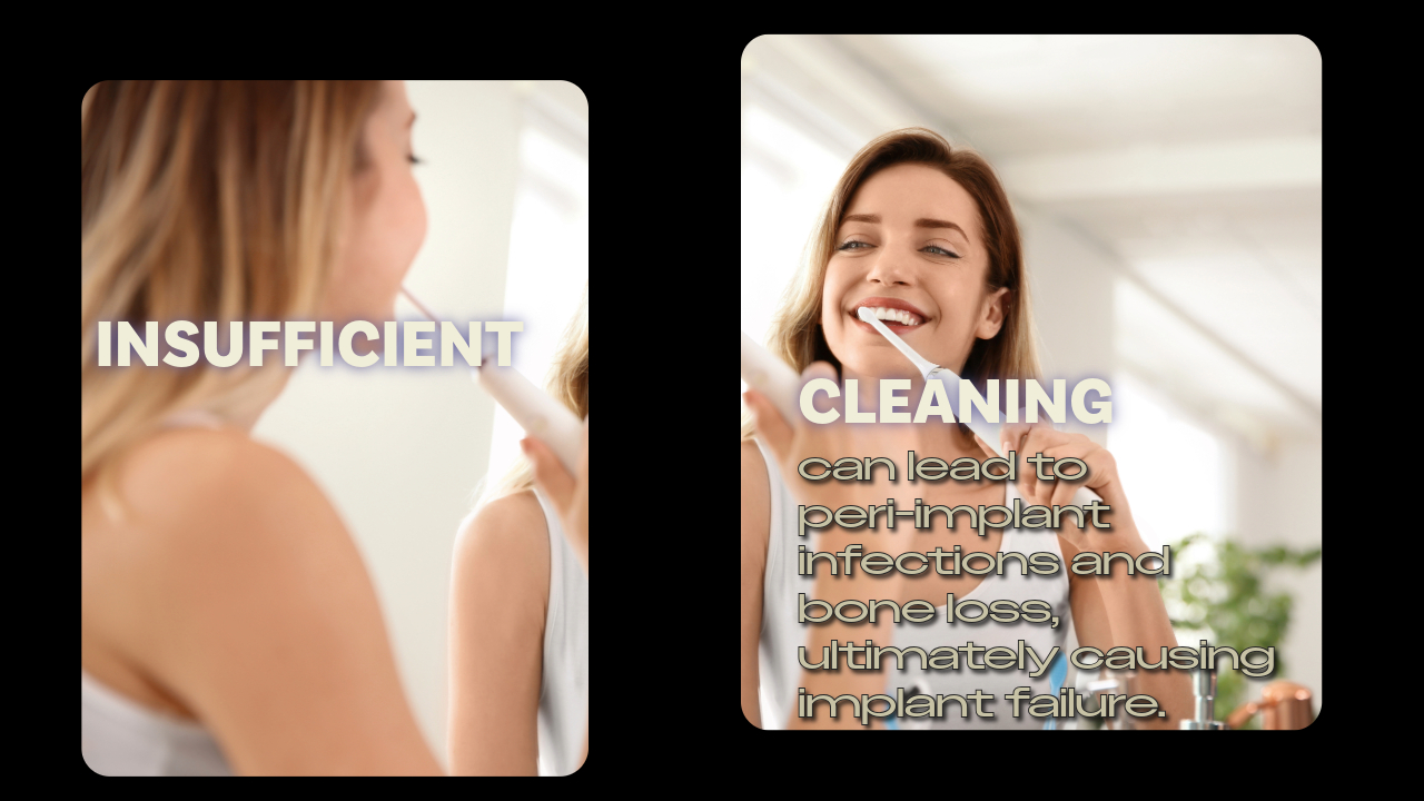 Products Used in All-on-4 Cleaning Products Used in All-on-4 Cleaning