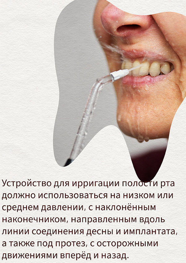 Полоскание рта ополаскивателем: Полоскание рта ополаскивателем: