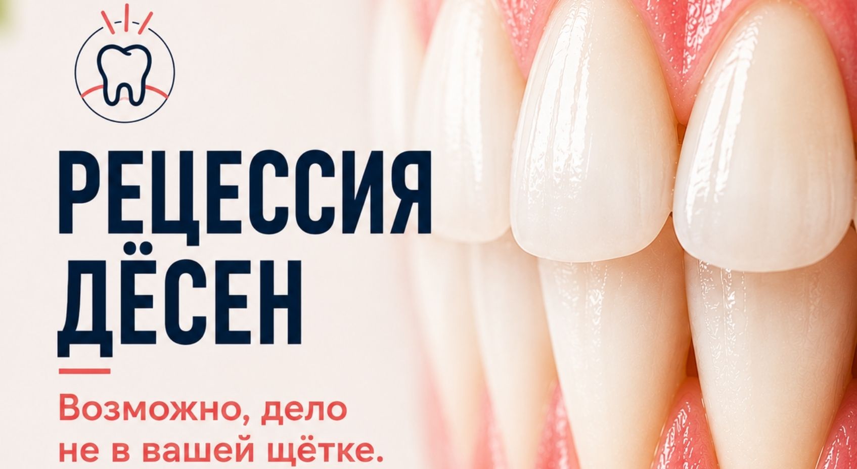 Можно ли вернуть десна на свое место? Можно ли вернуть десна на свое место?