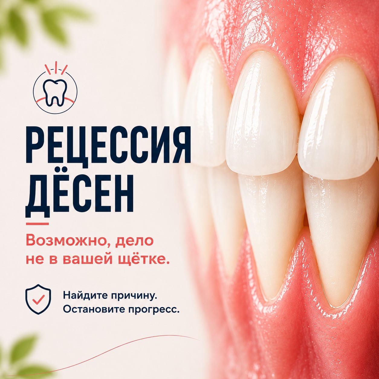 Можно ли вернуть десна на свое место?