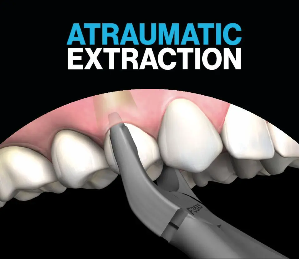 The role of atraumatic tooth extraction The role of atraumatic tooth extraction