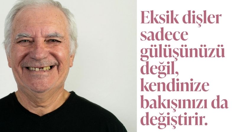Çiğneme ve beslenme sorunları olanlara diş implantı yapılabilir. Çiğneme ve beslenme sorunları olanlara diş implantı yapılabilir.