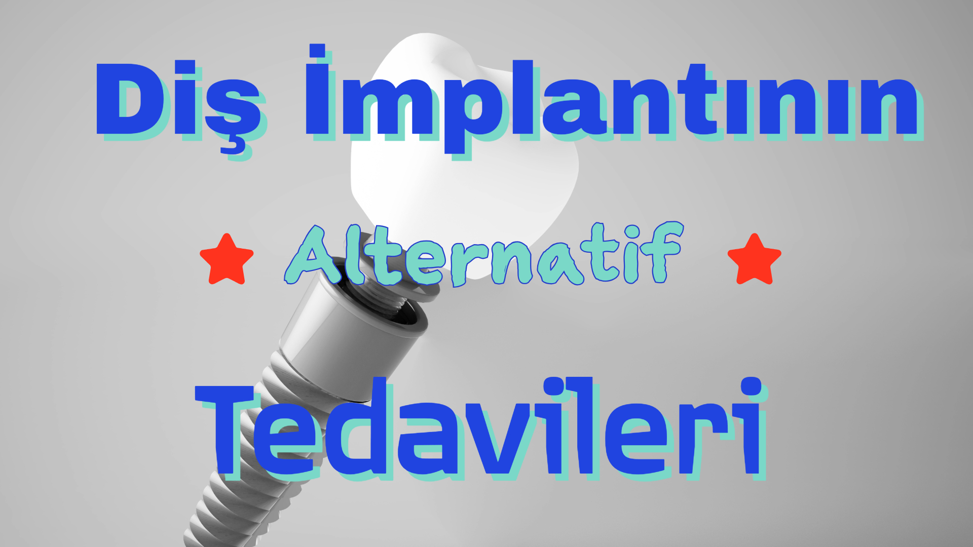 İmplant Tedavisinin Alternatifi Nedir? İmplant Diş Yerine Başka Ne Yapılır? - Antalya İmplant Tedavisinin Alternatifi Nedir? İmplant Diş Yerine Başka Ne Yapılır? Antalya