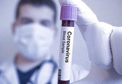 Koronavirüs (Covid-19) Döneminde Diş Tedavi Başvurusu ve Randevusu Antalya