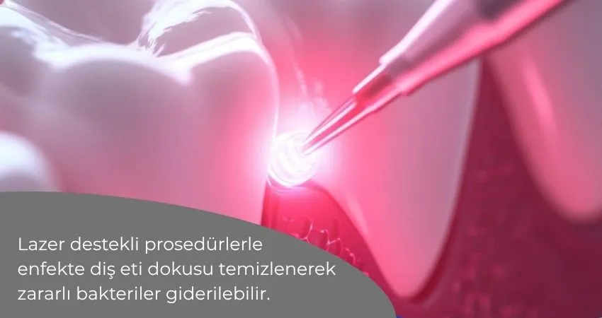 Lazerle diş eti hastalığı tedavisi Antalya