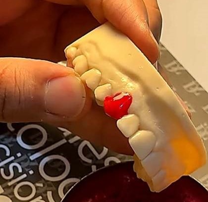 Was sind Grillz und wie werden sie hergestellt?
