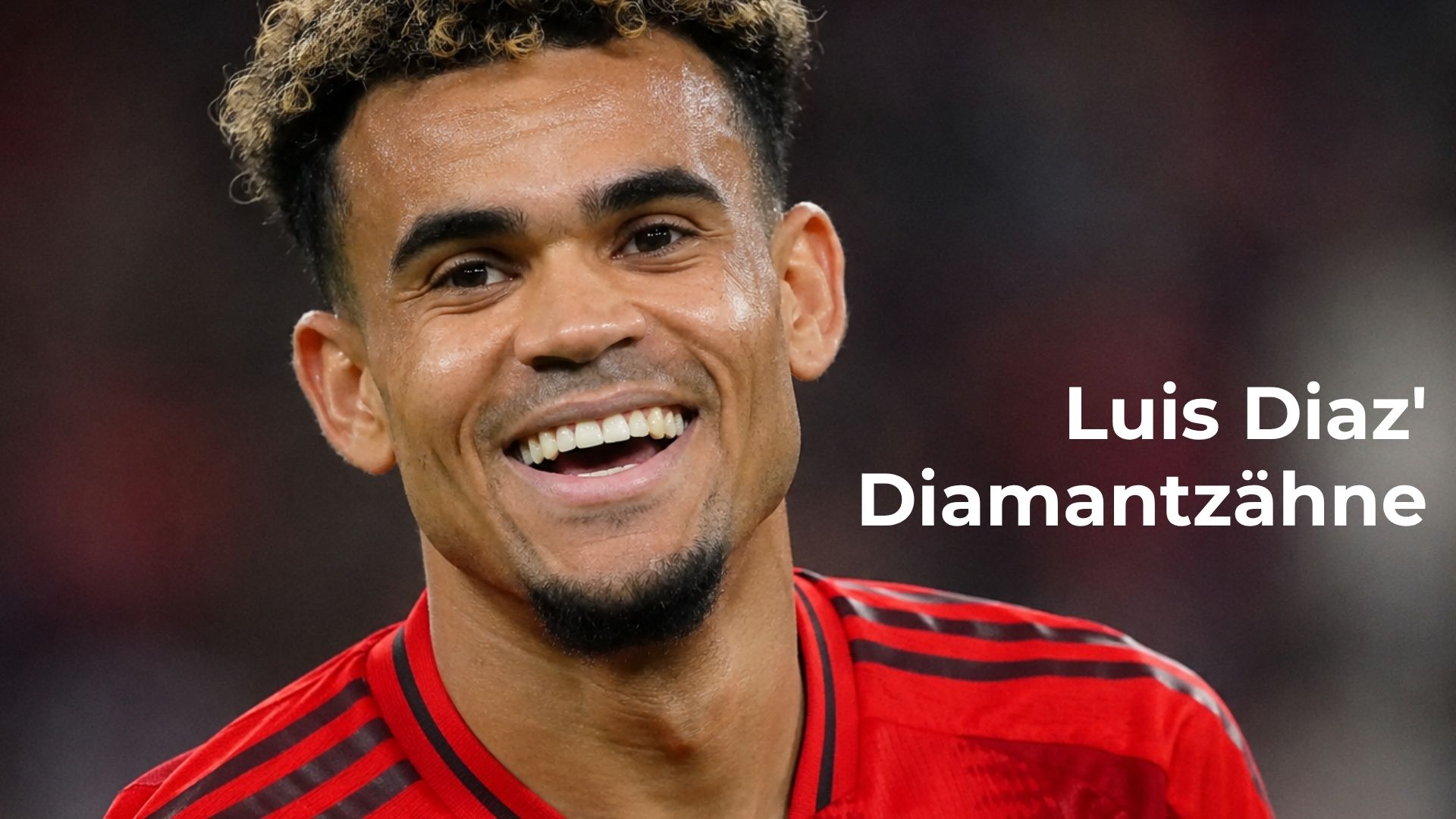Luis Diaz' Diamantzähne