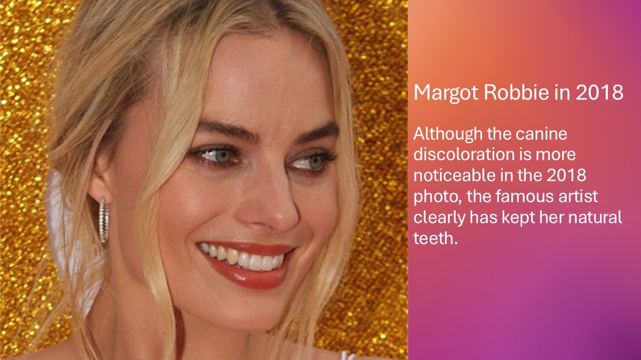 Margot Robbie s Teeth Does Margot Robbie Have Veneers 