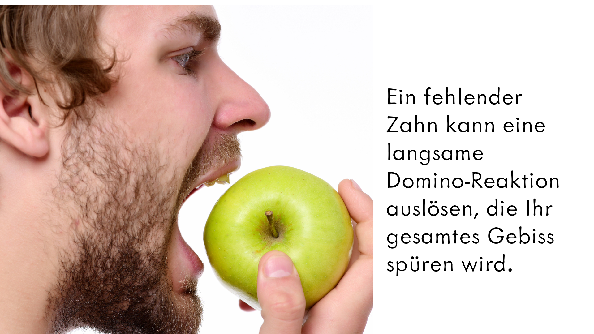 Zahnimplantate 