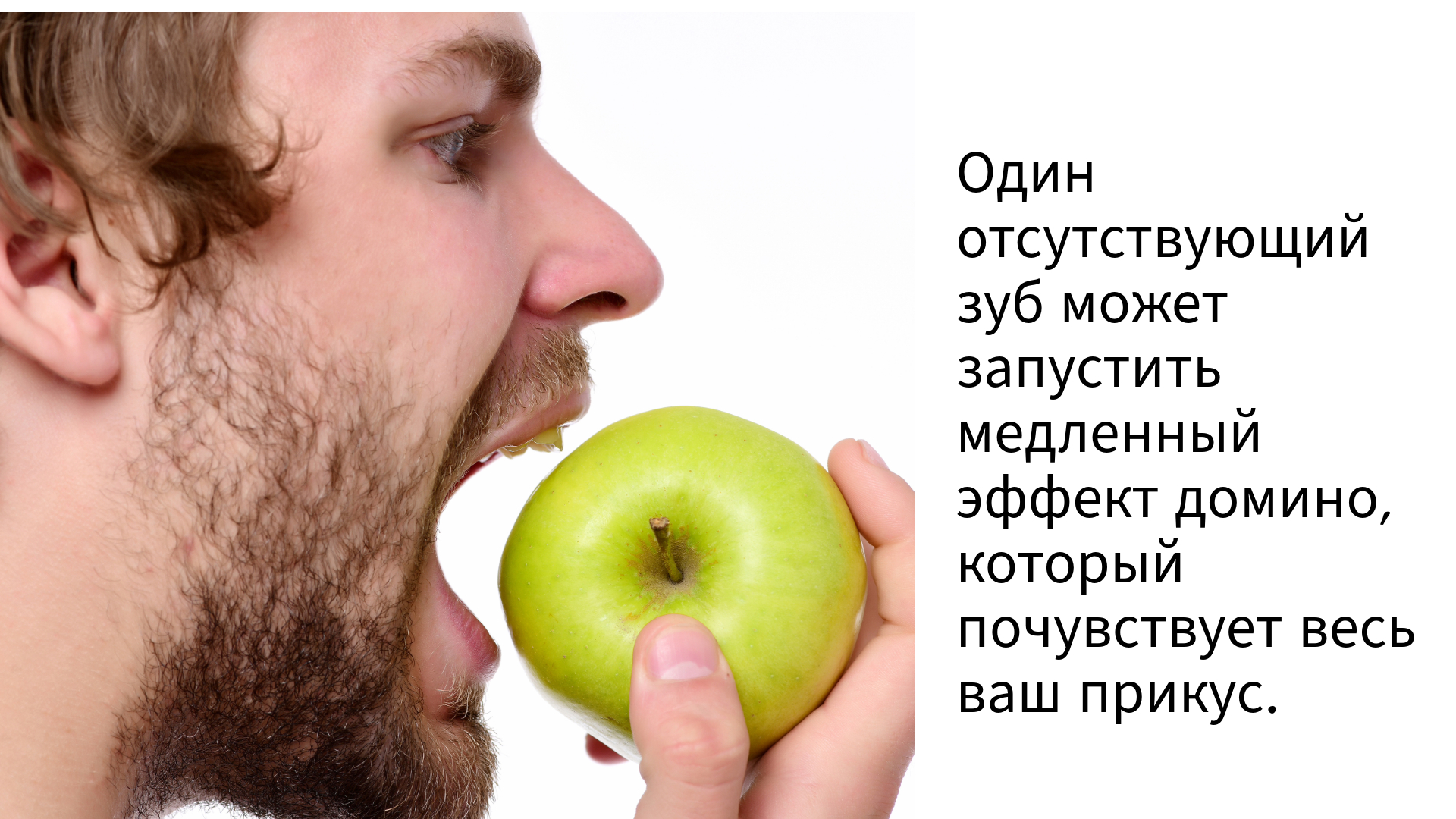 зубные имплантаты  