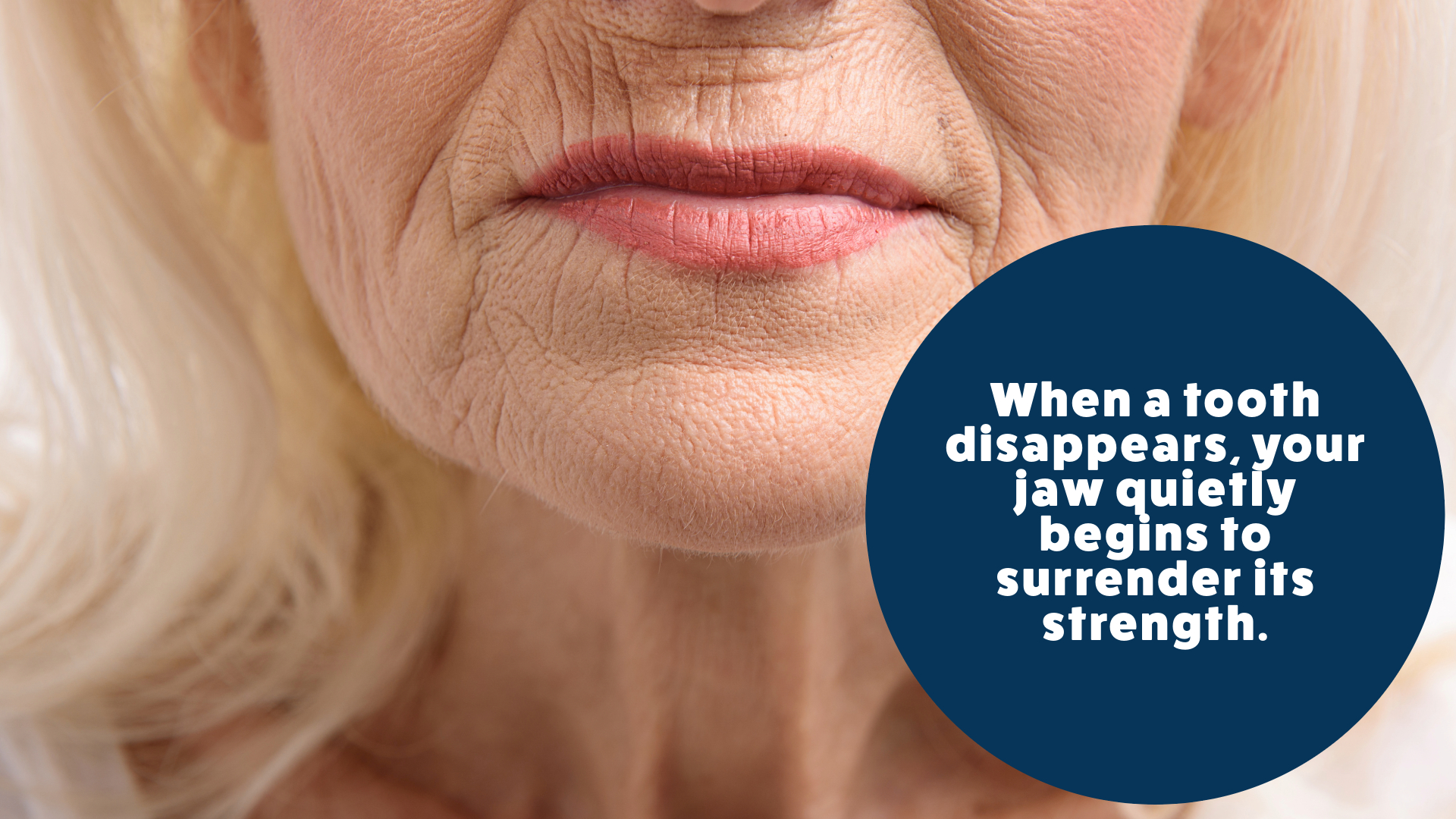 Jaw Bone Resorption Jaw Bone Resorption